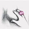 Gring XL. Anillo sweet raspberry - Imagen 9